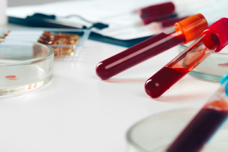 Lab Draws in San Antonio, TX 1 Close-up of test tubes arranged on a table
